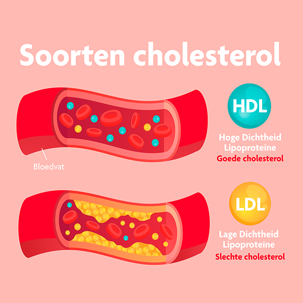 cholesterolverlagende voeding
